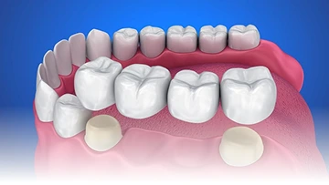 Layanan {{ result?.title }} Passion Dental Care