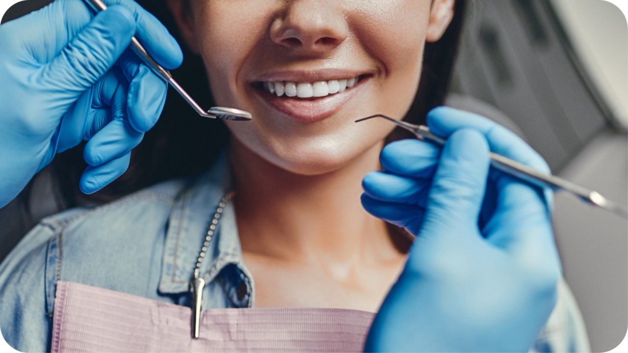 dental bonding | Passion Dental Care