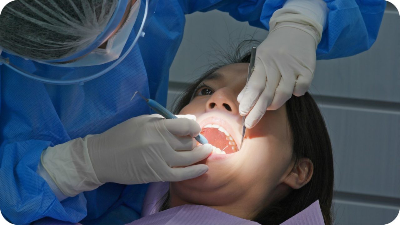 perawatan akar | Passion Dental Care