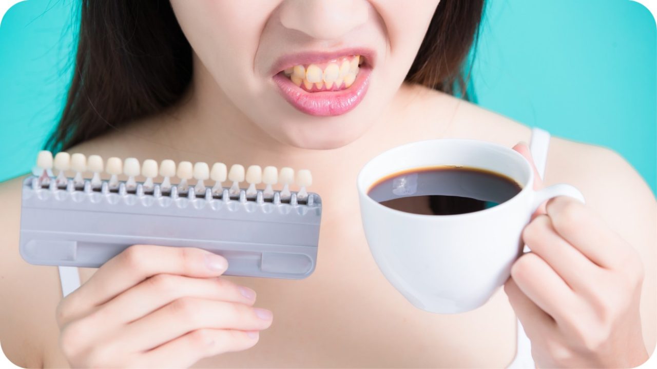 memutihkan gigi secara alami | Passion Dental Care