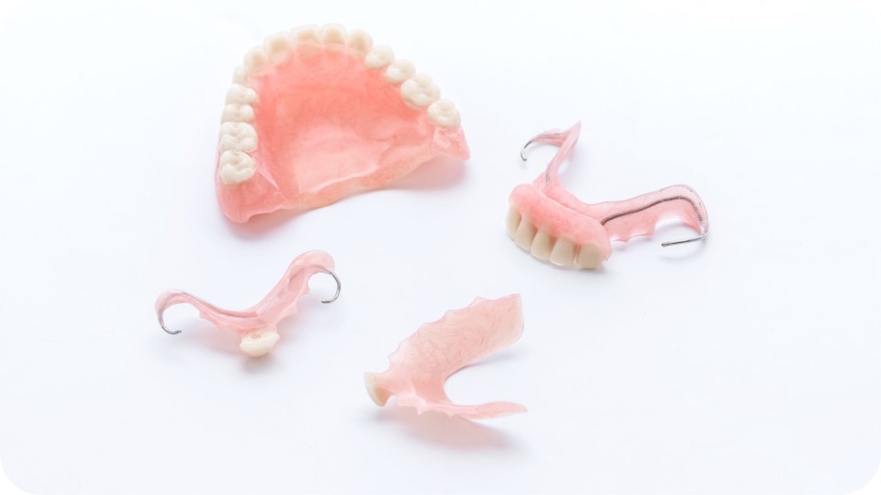 gigi palsu dan implan gigi 1 | Passion Dental Care