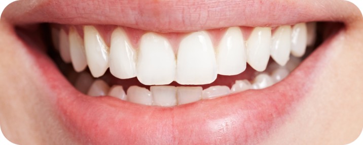 cara memilih pasta gigi whitening | Passion Dental Care