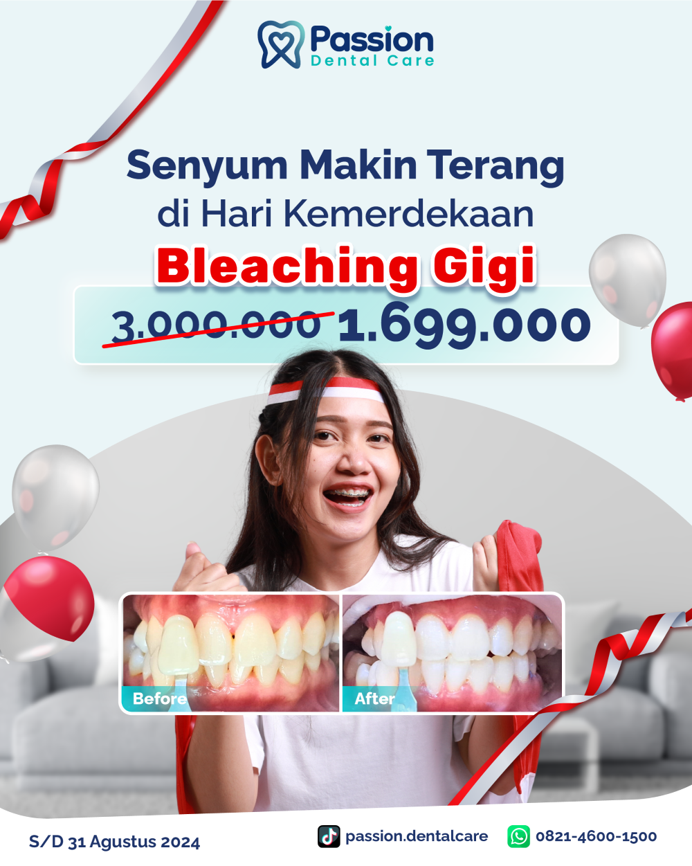 https://www.passiondentalcare.com/wp-content/uploads/2024/08/promo-agustus-01-01-01-2.png